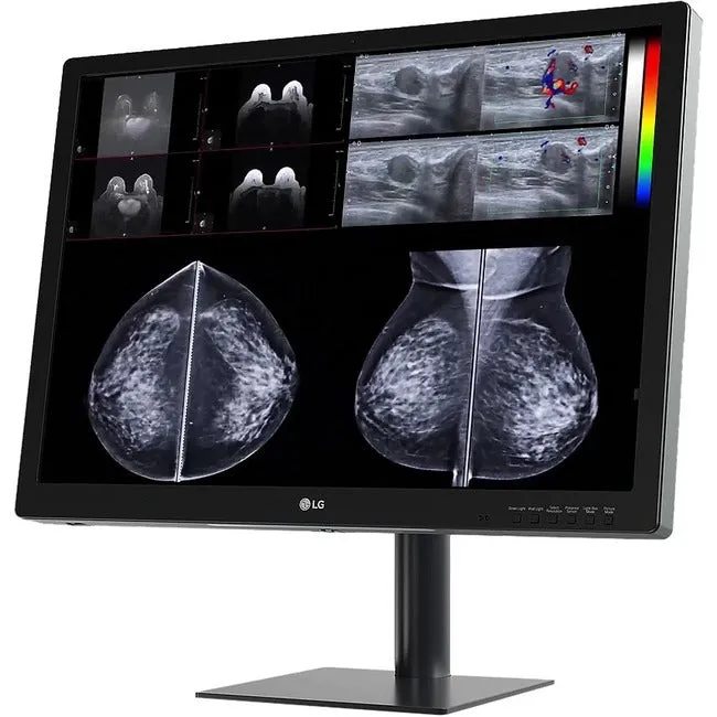 31In Lg Medical Anti-Glare, 3H Dignostic Monitor 4200 X 2800 (3:2) Class Ii Fda